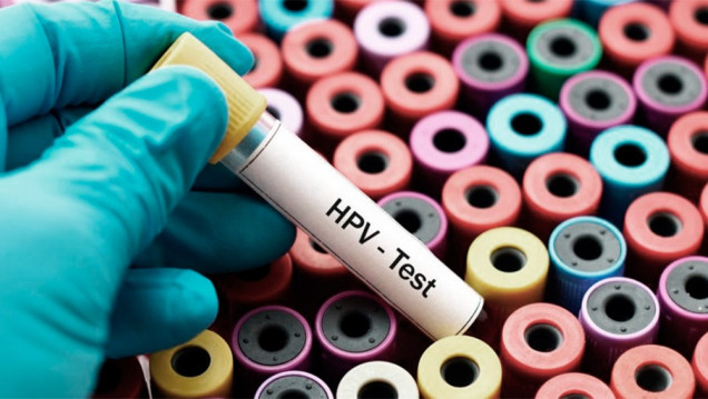 imagen A 10 años de la vacunación contra el VPH, lanzan un estudio para medir su impacto en el país