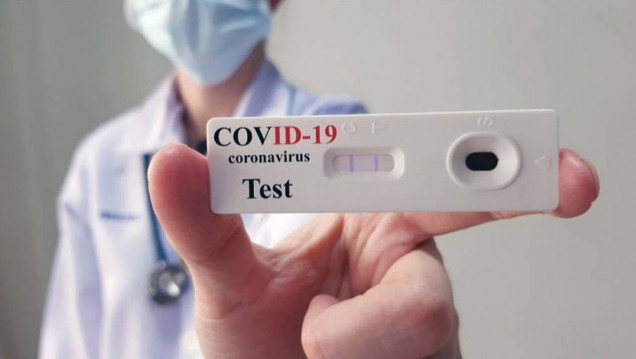 imagen En la última semana, aumentaron los casos de COVID y los testeos en Mendoza