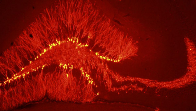 imagen Una investigación argentina detectó que el cerebro genera neuronas para "remodelar" memorias