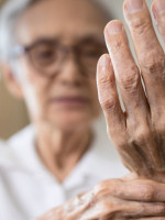 Artritis reumatoidea: 400 mil personas la padecen en Argentina y muchas tardan en ser diagnosticadas