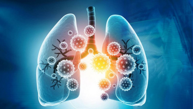 imagen Por los controles postcovid, se diagnosticaron más tumores de pulmón en estadíos tempranos