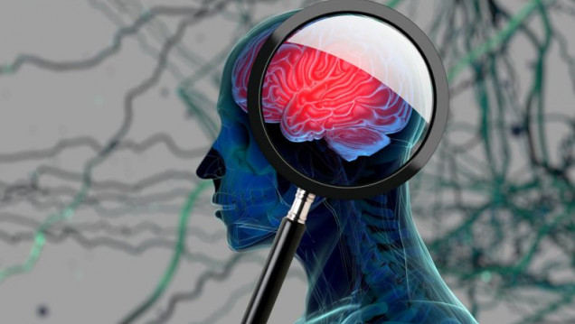 imagen Un software de desarrollo argentino podría diagnosticar de forma precoz el Alzheimer