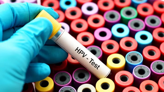 imagen Uno de cada tres varones tiene HPV y en uno de cada cinco es de alto riesgo