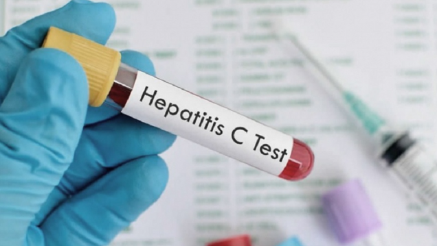 imagen Estiman que solo el 50% de las personas con hepatitis C están diagnosticadas