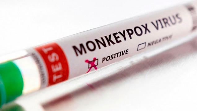 imagen Estados Unidos aprobó un test para detectar la viruela del mono