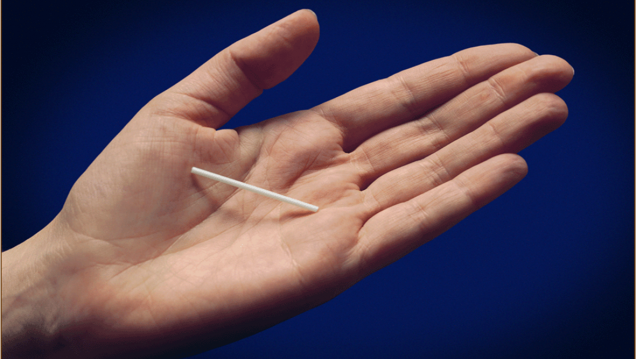 imagen Un implante anticonceptivo
