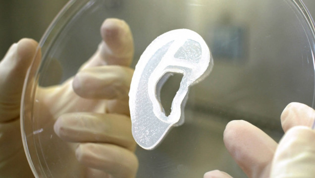 imagen Trasplantan por primera vez una oreja impresa en 3D con células humanas