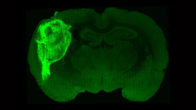 imagen Científicos instalaron células cerebrales en ratas para estudiar los trastornos psiquiátricos