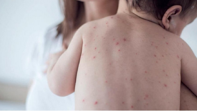 imagen Alemania propone multar a los que no vacunen a sus hijos contra el sarampión