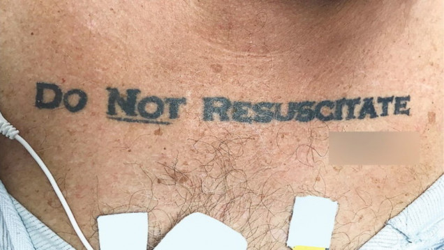 imagen "No resucitar", el tatuaje que abrió el debate de vida o muerte