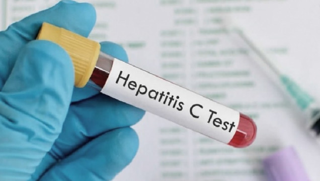 imagen Salud detectó el primer caso de hepatitis aguda grave en el país