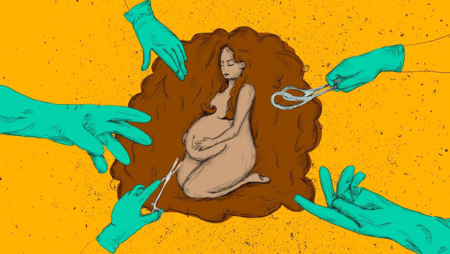 imagen La epidemia de cesáreas "es una forma más de control del cuerpo de las mujeres" 